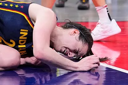 Sad news:Caitlin Clark’s WNBA playoff debut was marred by a painful incident when she suffered a black eye after…..